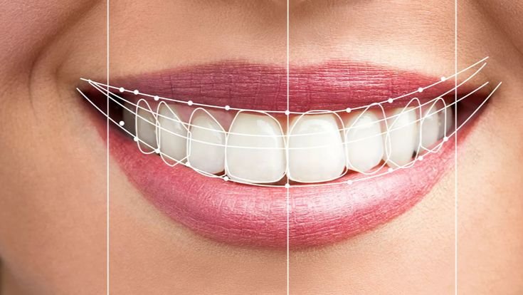 Digital smile designing at Best Smilles